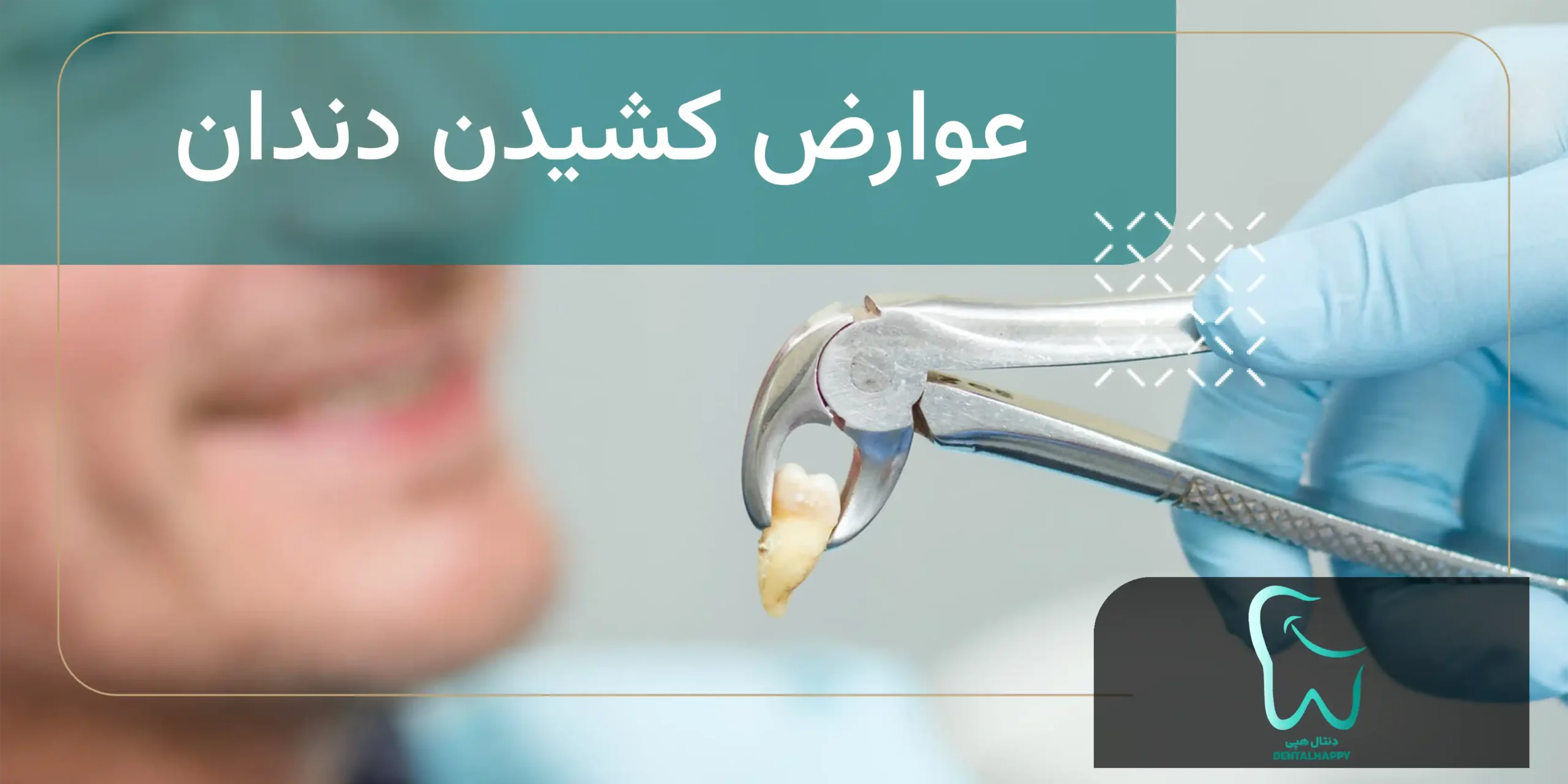 عوارض کشیدن دندان - دنتال هپی