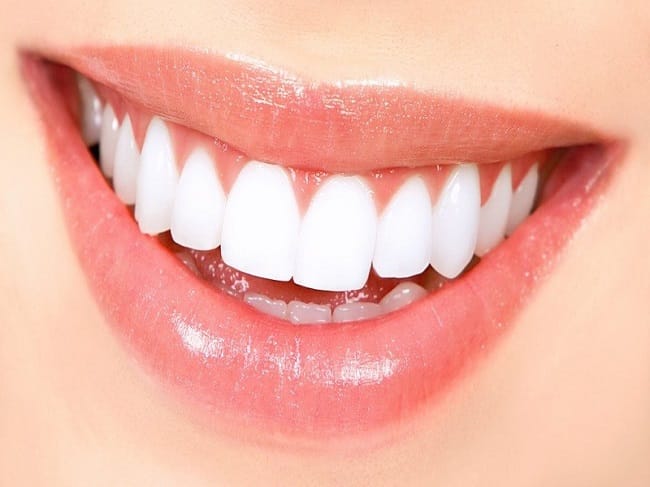 لمینت دندان خرگوشی
