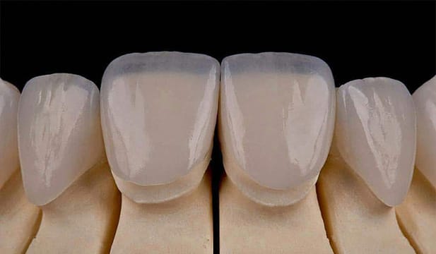 مراقبتهای بعد از نصب لمینت خرگوشی