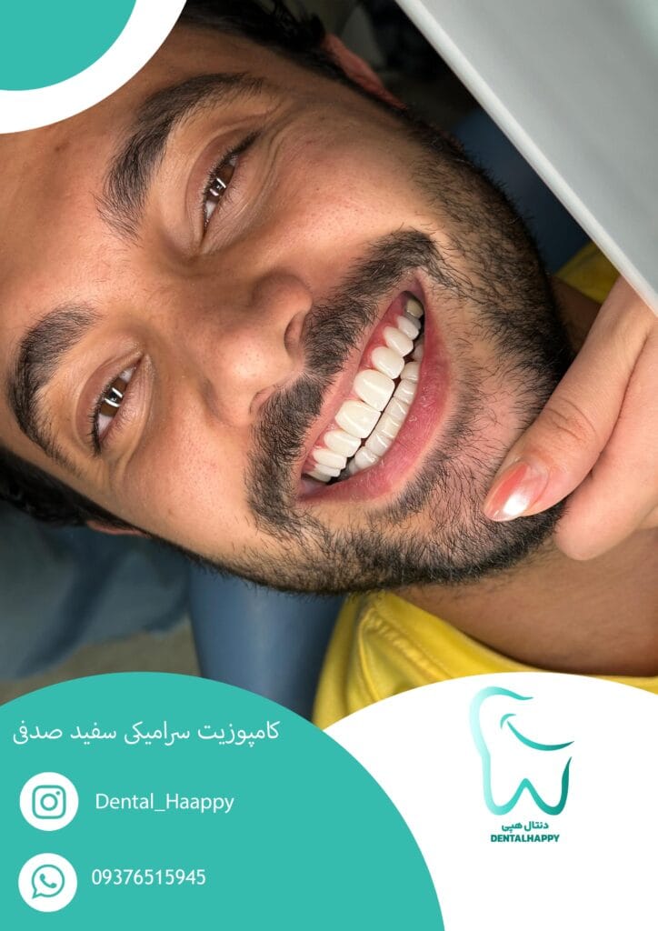 ایمپلنت دندان