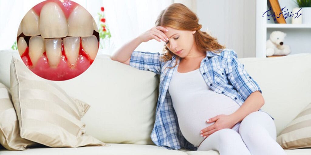 چگونه از پوسیدگی دندان در دوران بارداری جلوگیری کنیم؟